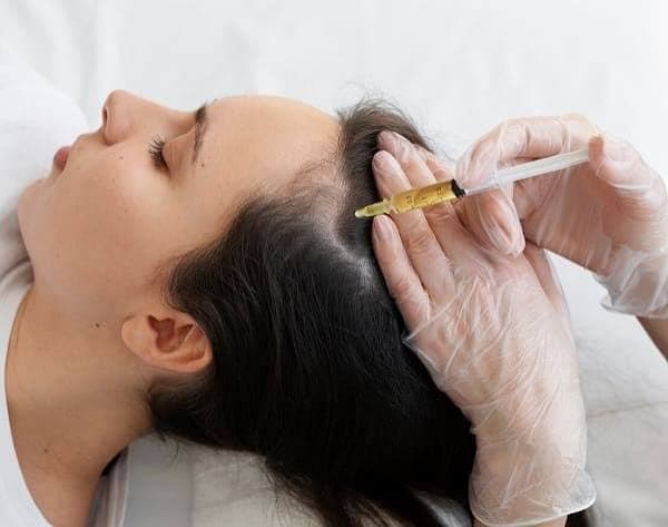 PRP Therapy